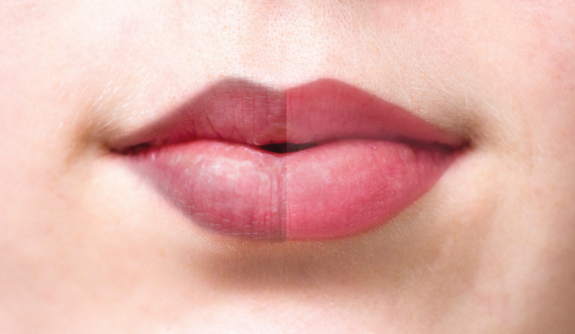 Bouche détatouée