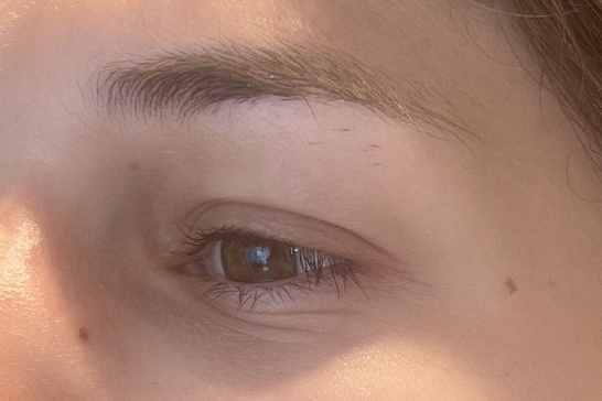 Maureen avant sa dermopigmentation du sourcil