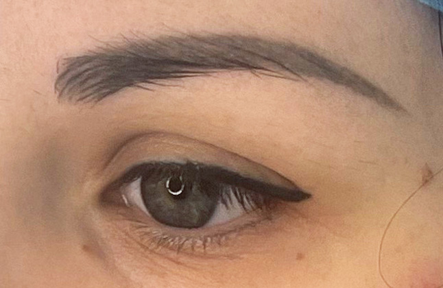 Sourcils avant la dermopigmentation