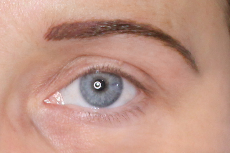 Après technique réhausse du sourcil