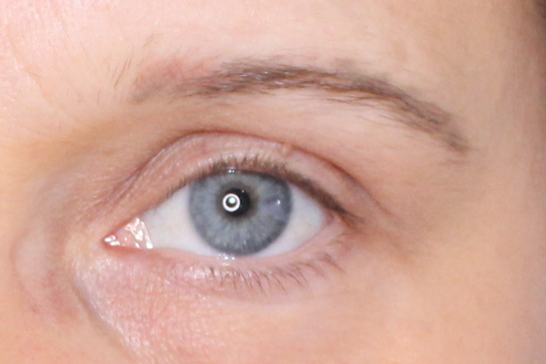 Avant technique réhausse du sourcil