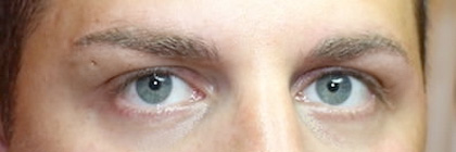 Sourcils homme après