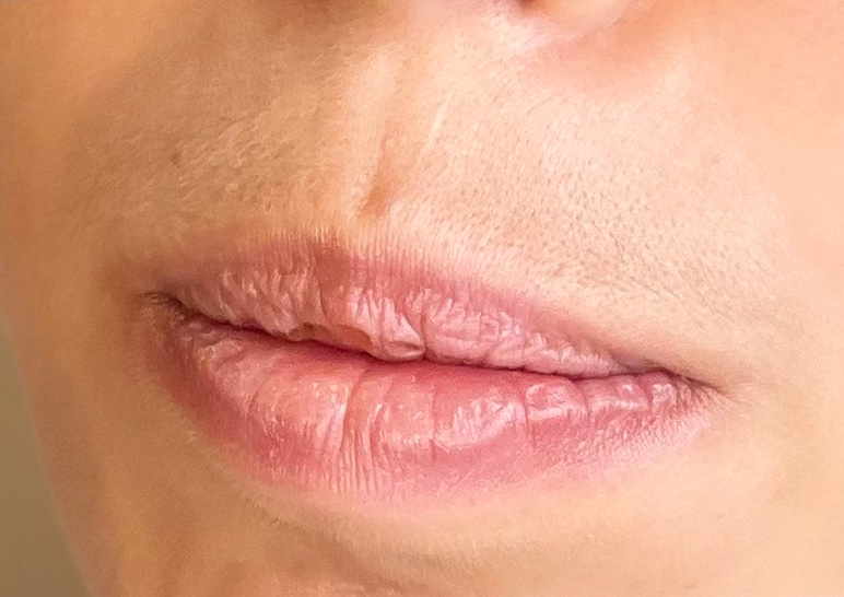 Bouche avant