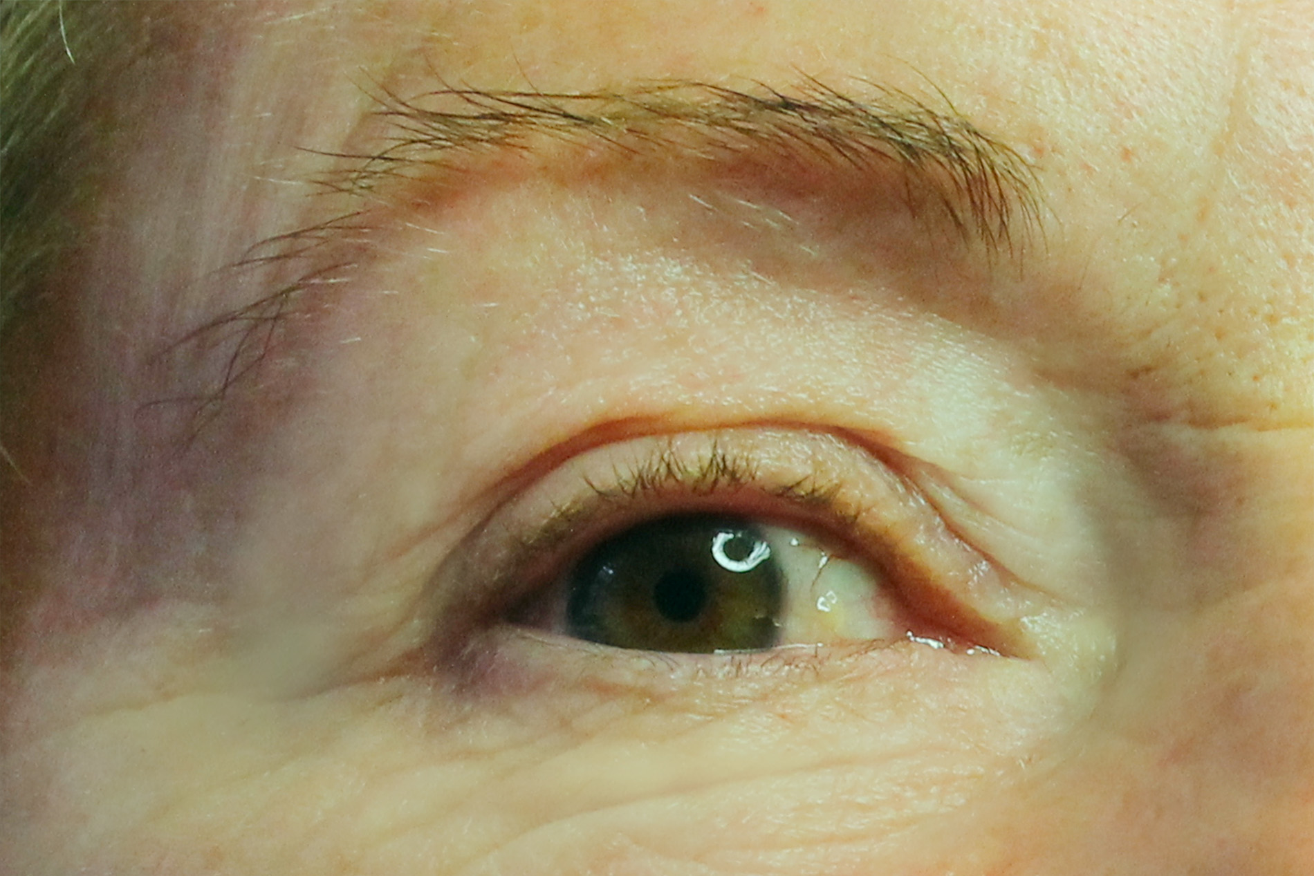 Oeil de biche avant 1