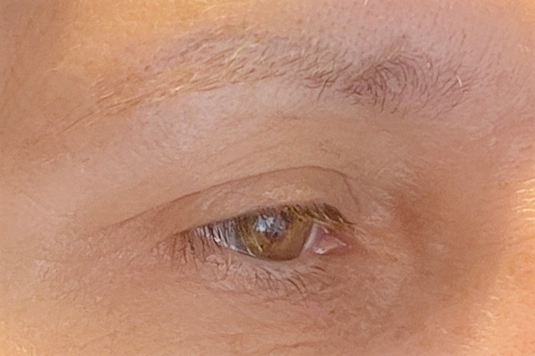 Sourcils avant dermopigmentation
