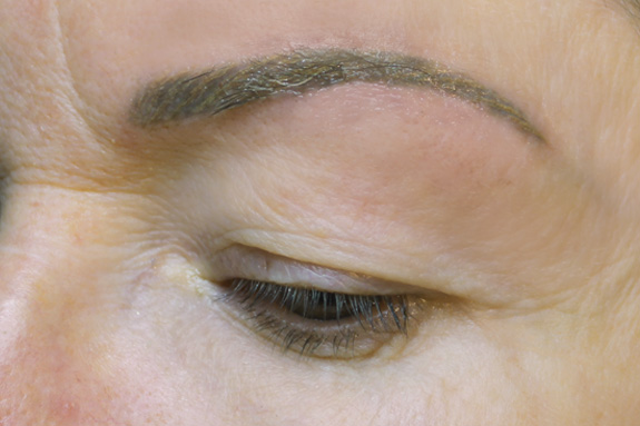Sourcils après structuration