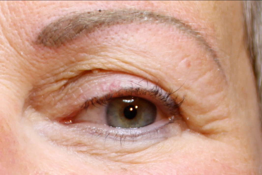 Sourcil après dermopigmentation