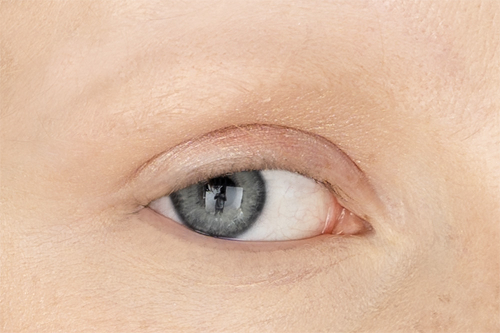 femme perte sourcil