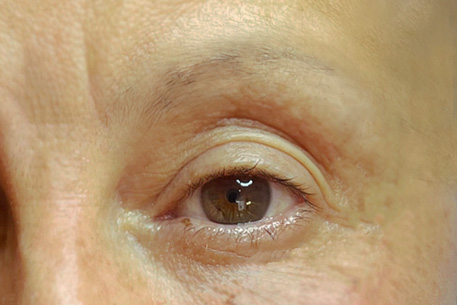 Sourcil avant